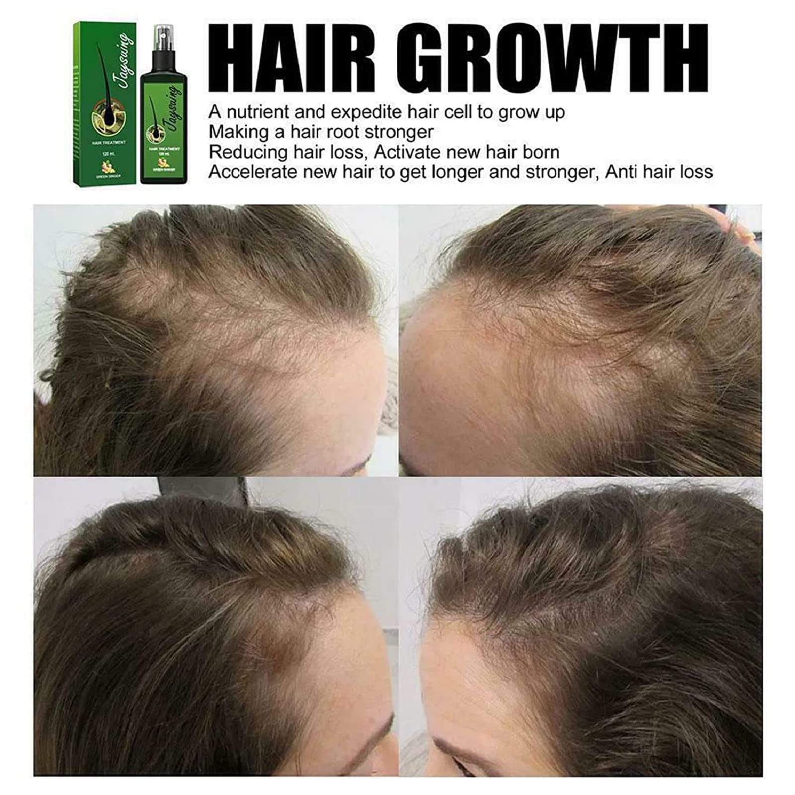 Buy Hair Growth Serum Hair Lotion for Men Women, Growthplus Nourishing