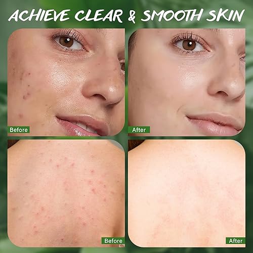 Miniatura 6 de Jabón de aceite de árbol de té para cara y cuerpo, jabones de baño orgánicos naturales para pies de atleta, olor corporal, acné, limpieza profunda,