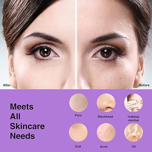 Miniatura 11 de NågraCoola CLIE Cepillo de limpieza facial, limpiador facial eléctrico impermeable y recargable para hombres y mujeres, exfoliante, masaje y Rosado