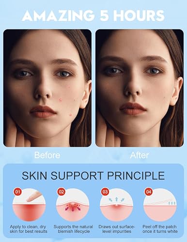 Patch Bouton Hydrocolloïde, Pimple Patch, 250 unités, 7 tailles, 5 formes, 5 couleurs, Soin anti-boutons, Motif étoile multicolore mignon, Absorbe le liquide des boutons–Résultats en 3 h Acne Patches - 5
