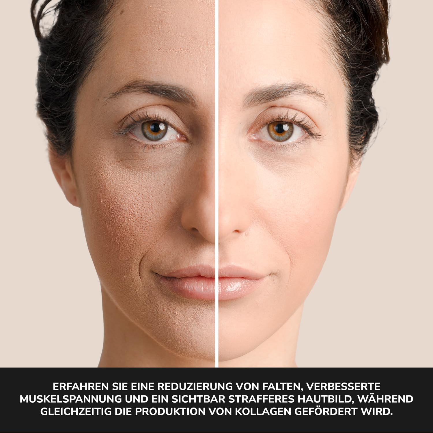 Radiofrequenz-Gerät für das Gesicht: Hautstraffung mit 20 RF-Modulen und Mikrostrom EMS Technologie, Stempel- und Gleitmodus, NTC-Temperatursensor, 3,5mm Eindringtiefe für Anti-Aging