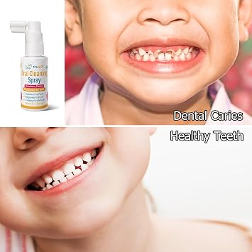 Kids Oral Spray, Toddler Toothpaste Helper for Cavity Prevention and Fresh Breath, Children Anticavity with Fluoride Free for Newborn to Preschoolers, Kid's Mouth Spray (2)