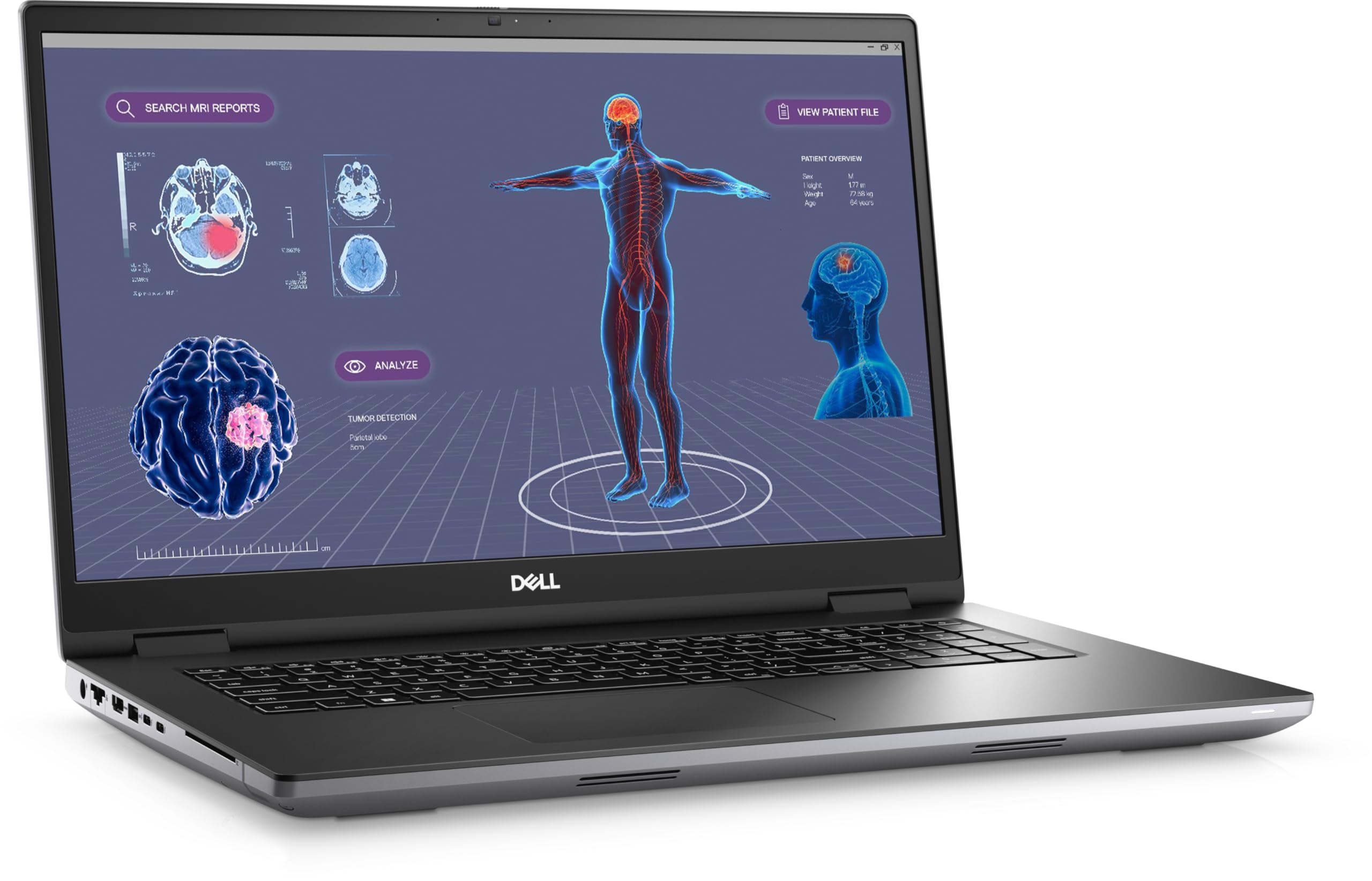 Dell Precision 7780 Mobile Workstation - 17.3