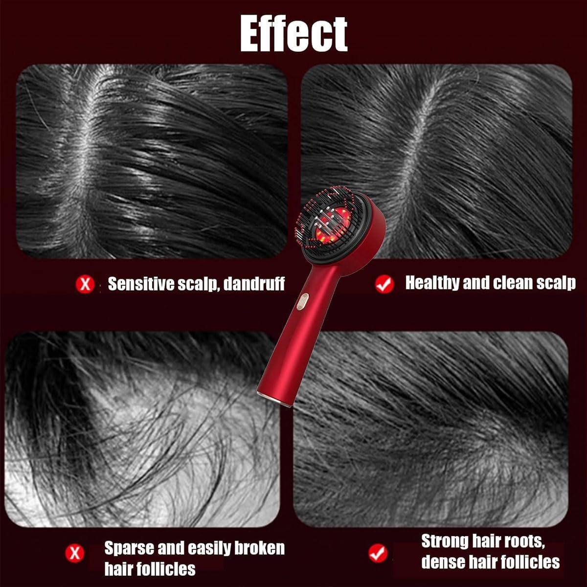 Masajeador de Cabello, masajeador de Cabello con luz roja, Masaje de amasamiento de 360°, masajeador de Cuero cabelludo eléctrico de 3 velocidades