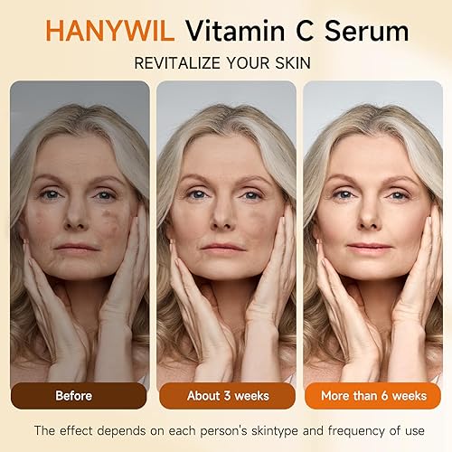 Miniatura 4 de HANYWIL Suero súper vitamina C para mujeres mayores de 70 años, suero de vitamina C para cara, removedor de manchas oscuras para el rostro, cuidado