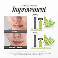 Vista 4 de Trouble Patch Mask – Full Face Pimple Patch – Hydrocolloid Face Mask for Acne-Prone Skin, Covers Multiple Breakout Areas, Absorbs Excess Oil &