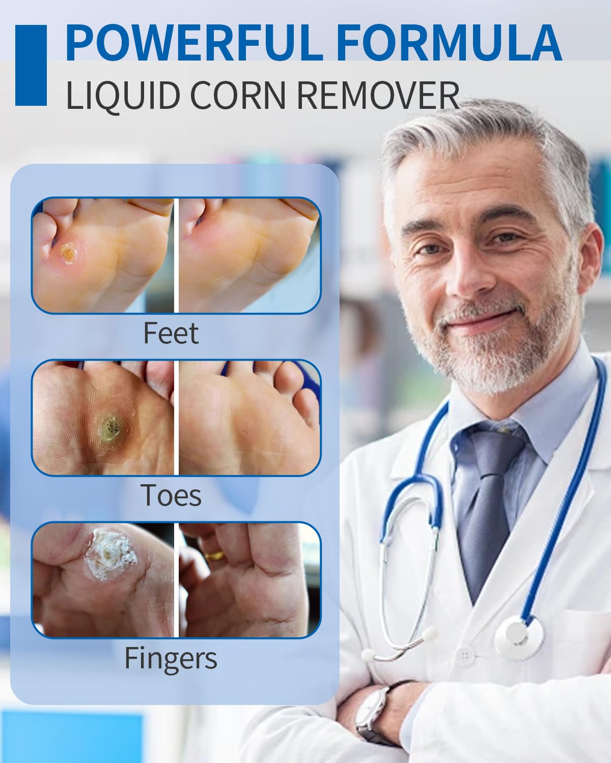 MQ 2Pcs RIMOZIONE LIQUIDA DI VERRUCHE E CALAMBRE, 15ml Rimuovi Verruca, Soluzione Contro Calli e Duroni, Rimuovi Calli, Rimuovi Verruche, Alleviamento del Dolore da Mais e Cura dei Piedi