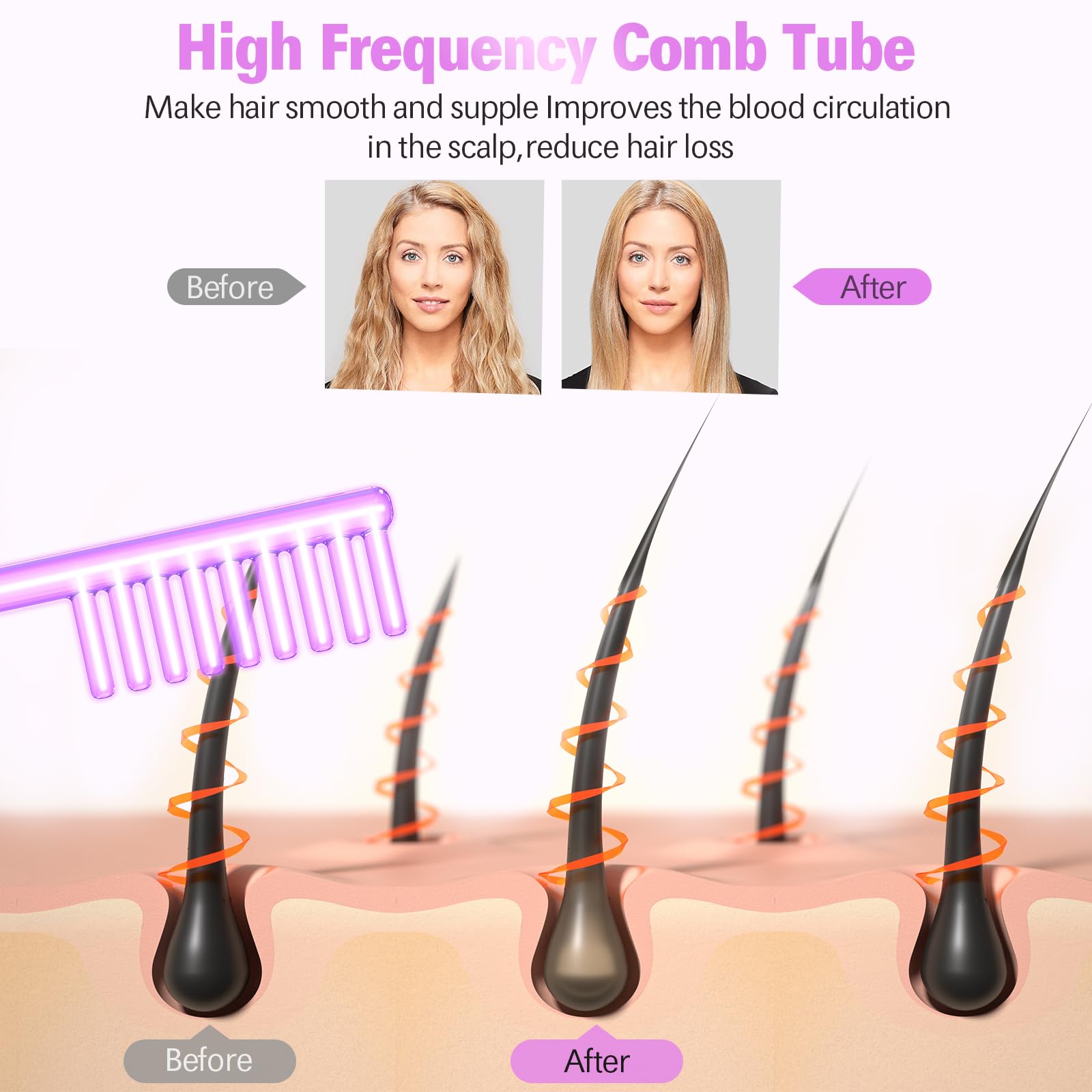 Varilla de electrodo de mano portátil de alta frecuencia, tubo de cristal, dispositivo de terapia de piel con 4 varillas de argón, tratamiento del acné, reafirmación de la piel, reducción de arrugas.