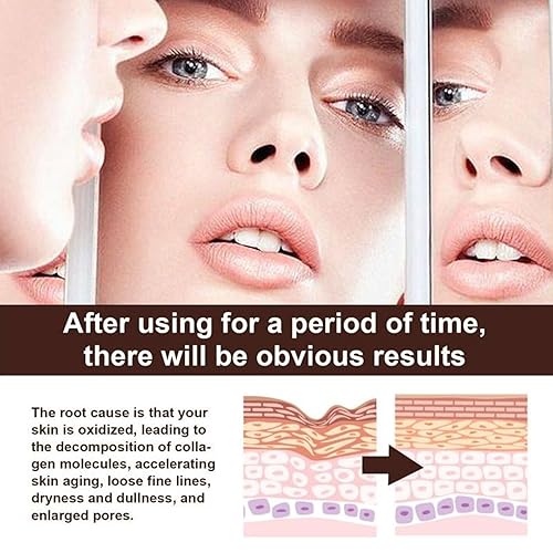 Miniatura 2 de Crema de retinol para la cara, crema facial de retinol con ácido hialurónico, crema nutritiva antiarrugas reparadora para el cuidado de la piel,