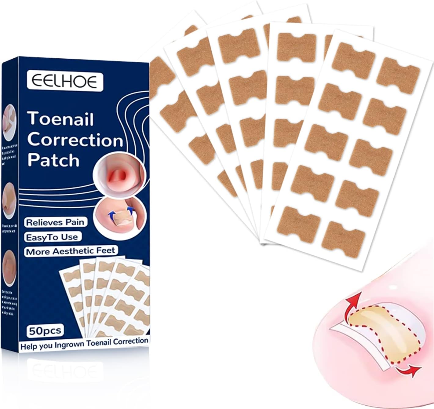 Ingrown Toenail Corrector Stickers,SUPRROW Toe Nail Corrector Patch for