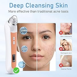 Facial Pore Blackhead Remover Vacuum, 1080P Camera Blackhead Remover, 20x Zoom, 8 LEDs  3 Suction Modes, 800mAh Battery & USB - 6 Heads Pore Cleaner Kit for Women&Men(Orange)