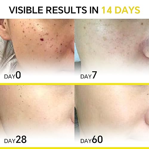 Miniatura 2 de JING MENG SUERO DE CALANO, SUERO B5, SERUM PRO VITAMINA C, SUERO DE RETINOL LIPOSOMAL, SENTIMIENTO ÚNICO, SALUDA A LA CARA DEL BEBÉ, REGALO DE