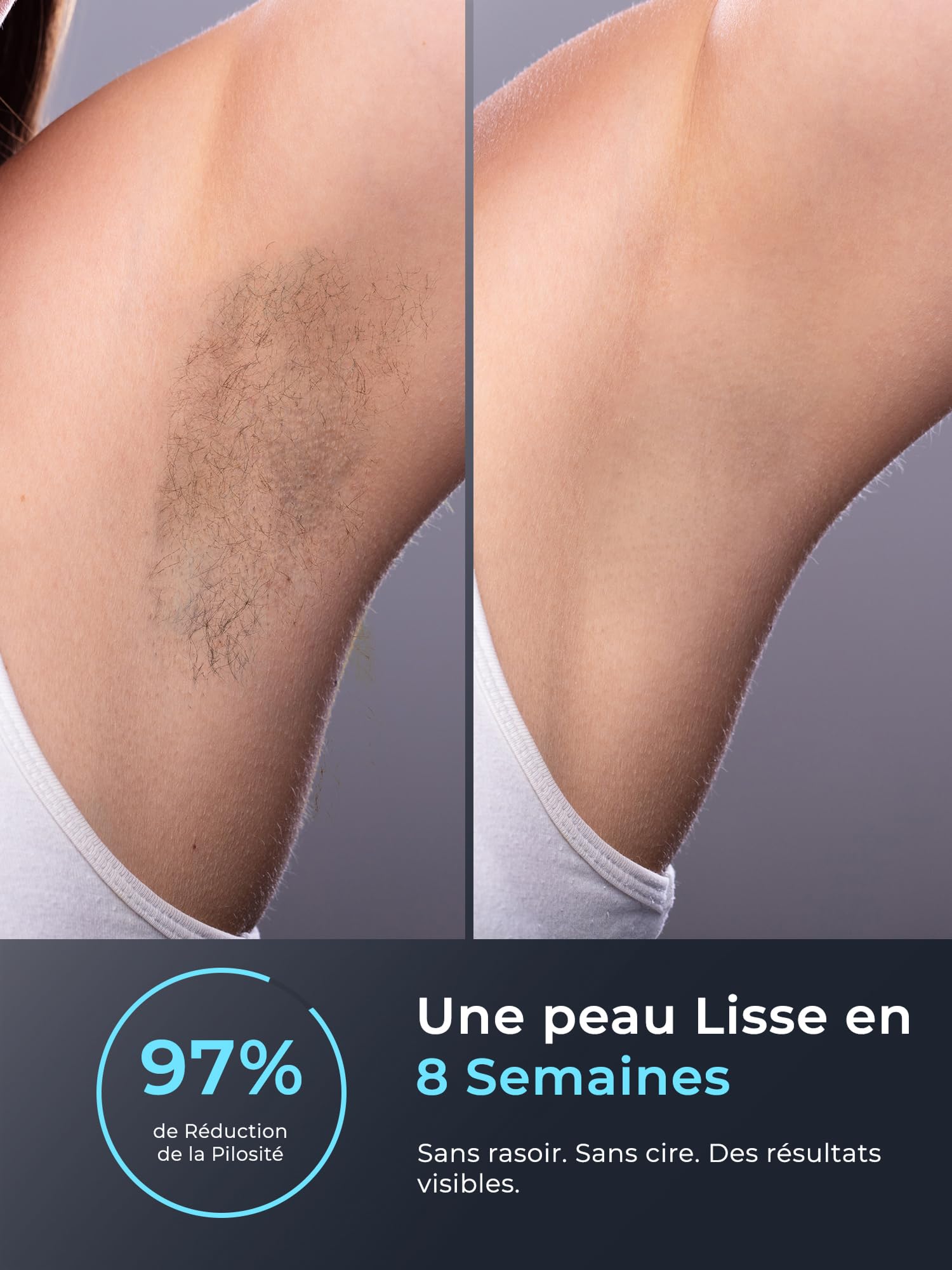 21J Epilatore Luce Pulsante con Funzione di Raffreddamento, 9 Livelli di Luce Pulsante, Epilatore Laser per Donna e Uomo, Ascelle, Braccia, Schiena, Zona Bikini