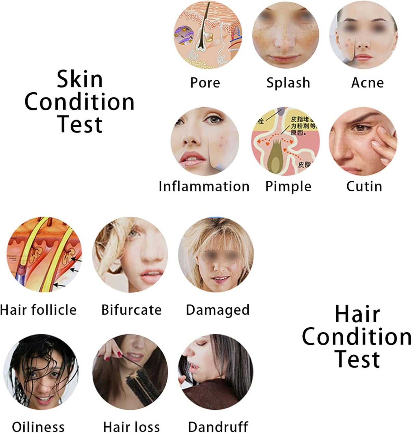 Asixxsix Skin Diagnosis Hair Analyzer, 5 Inch LCD Screen Digital Skin Detector Tester Hair Skin Analyzer Rechargeable Follicle Skin Oil Magnifying Tester