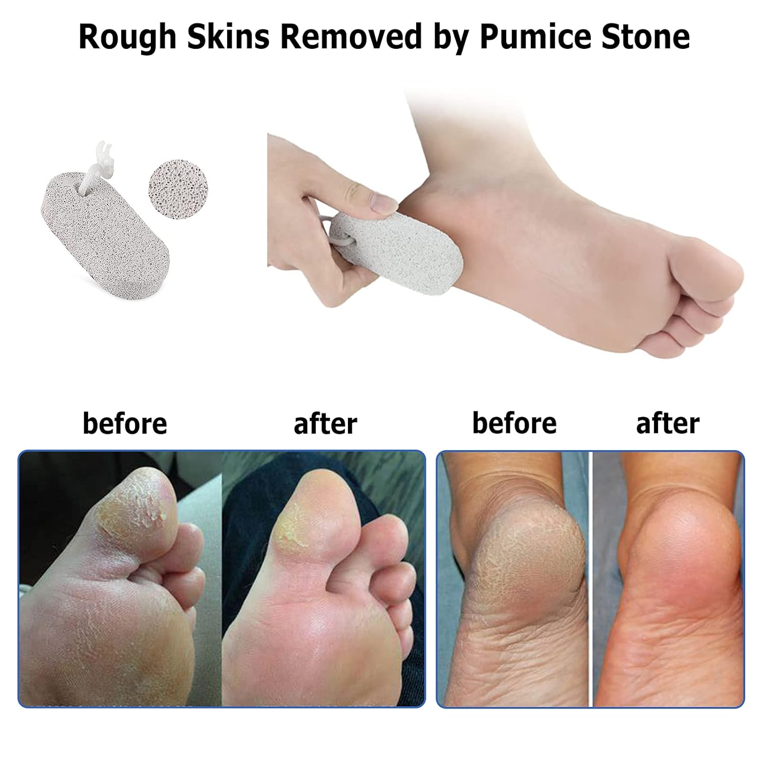 Moisturizing Socks, Aloe Socks, Foot Spa Gel Silicone Socks for Women (2 Pairs), Pedicure Socks for Repairing Dry Feet, Cracked Heel and Softening Rough Skin, Calluses, Pumice Stone for Feet : Beauty & Personal Care