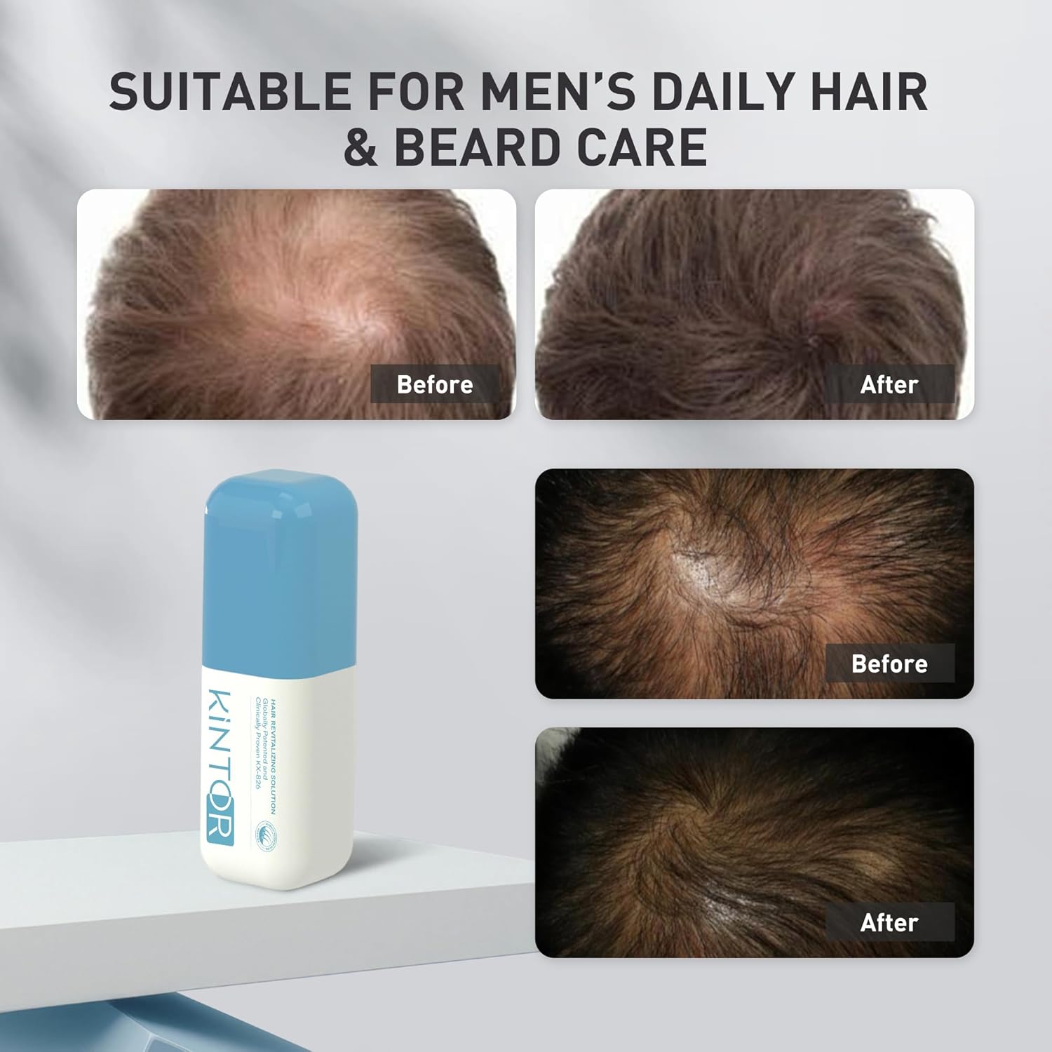 KINTOR 0.5% KX-826 Hair Growth Spray for Men, DHT Blocker Hair Regrowth Products，Anti-Hair Loss Serum for Stronger, Thicker Hair Roots, Reduce Hair Loss Amount, Basic Version 60ml