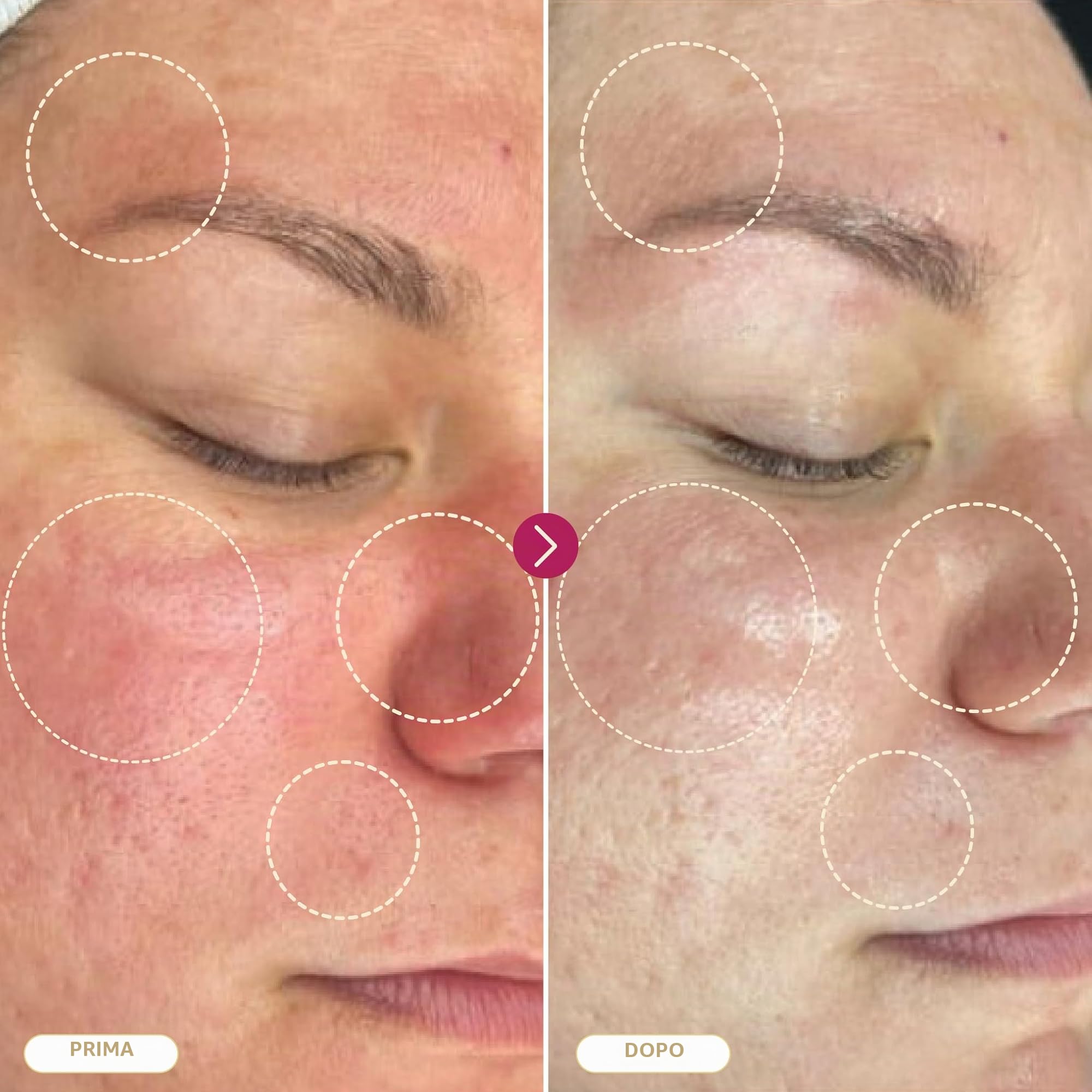 BASE LABORATORIES Spray acido ipocloroso, guarigione della pelle per ferite, soluzione spray per la cura delle ferite, eczema, tatuaggi e piercing | lavaggio delle ferite con soluzione salina