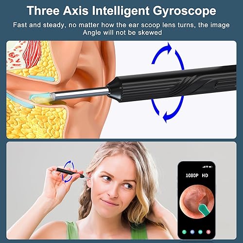 Miniatura 5 de Herramienta de eliminación de cera de oído con 8 piezas, limpiador de oídos con cámara, eliminación de cera de cámara de oído con cámara de