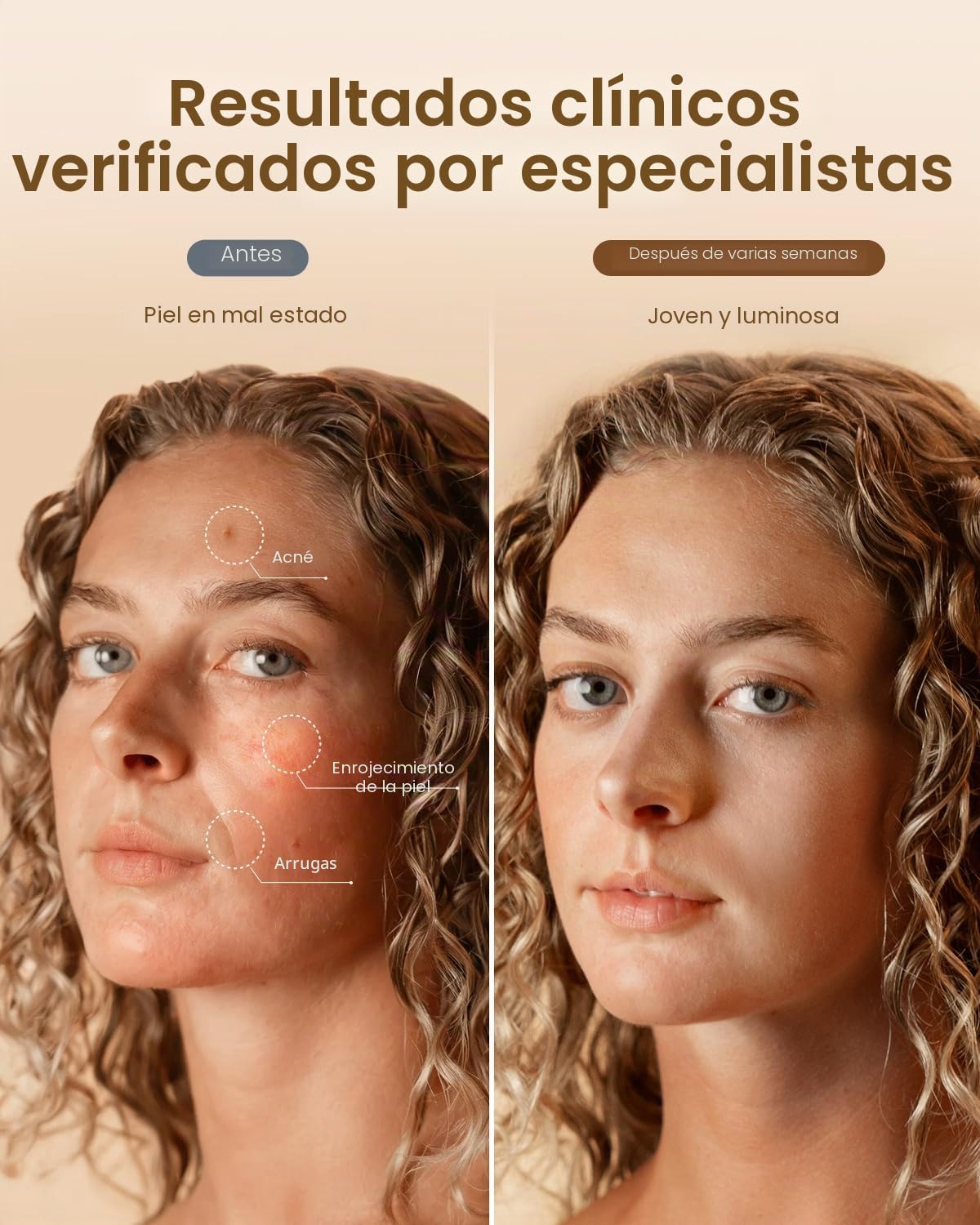 Mascarilla facial suave con luz LED RENPHO, mascarilla facial de silicona, 324 LED de cobertura facial completa y 3 modos de luz, mamás y esposas, para mujeres recargable para viajes 2026