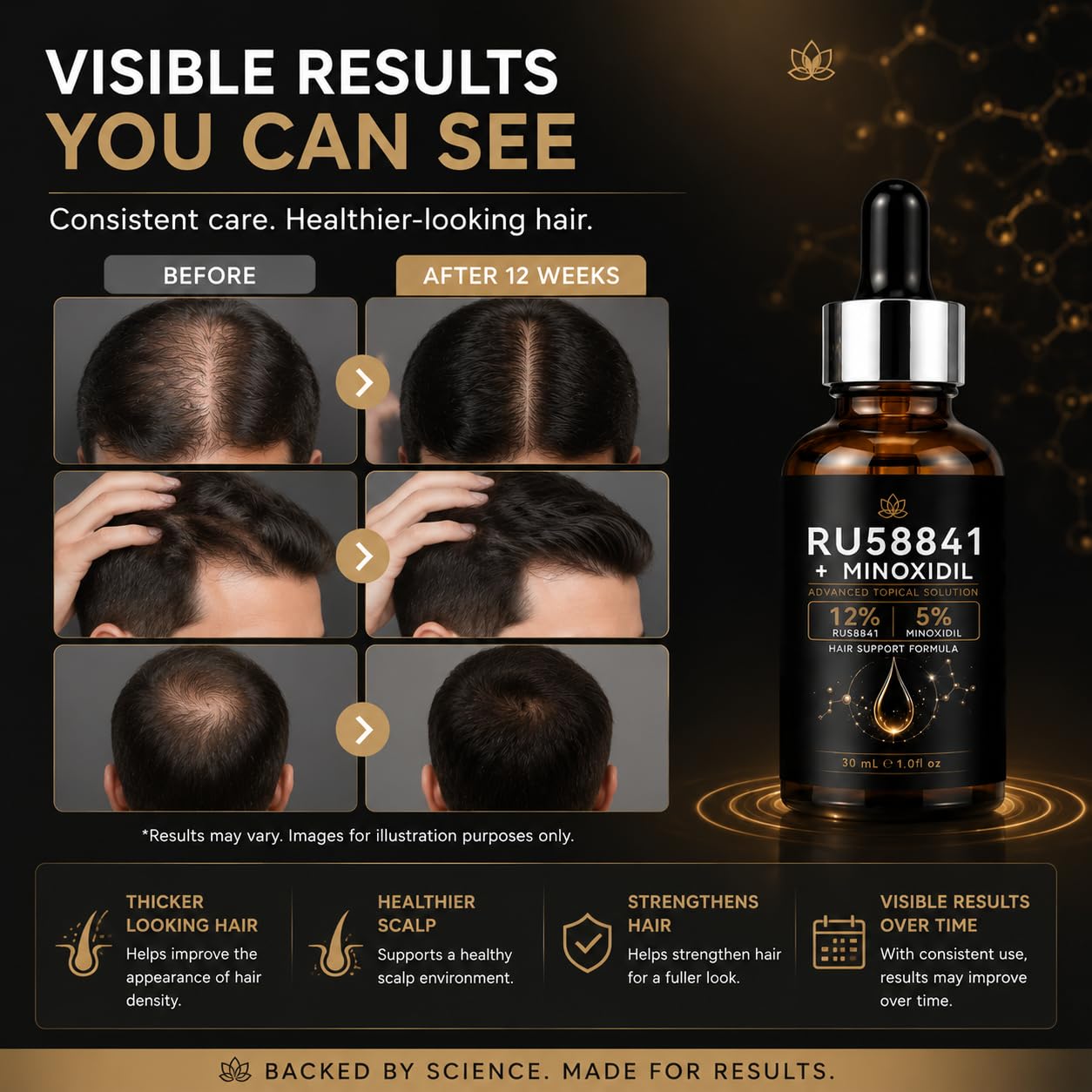 RU58841 12% + Minoxidil 5% Hair Rescue - Hair Growth Serum - 30ml