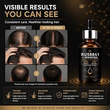 RU58841 12% + Minoxidil 5% Hair Rescue - Hair Growth Serum - 30ml