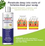 Folliculitis & Seborrheic Dermatitis Shampoo – Anti-Dandruff Scalp Care for Itchy, Flaky, Dry Scalp, Helps Relieve Irritation & Discomfort