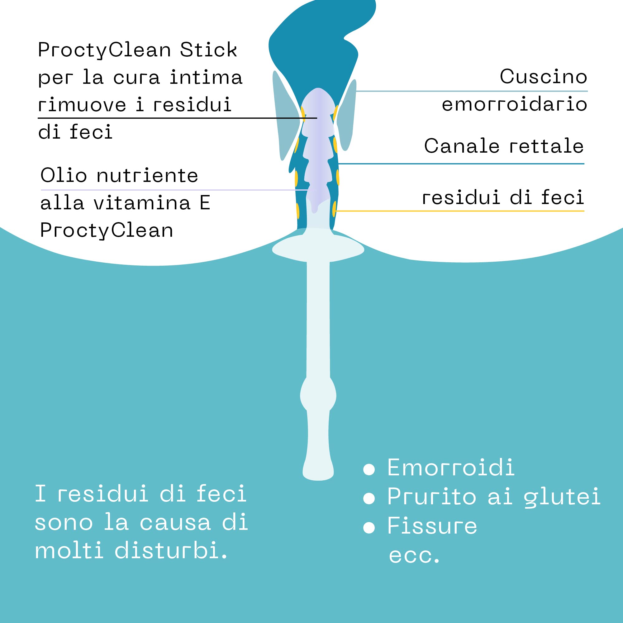 ProctyClean Kit per l'igiene intima del sedere. Brevettato! Aiuto rapido attraverso l'igiene intima. Soprattutto in caso di emorroidi, ragadi anali, prurito e bruciore. Per donne e uomini. | Brevettato, Aiuto rapido attraverso l'igiene intima. Soprattutto