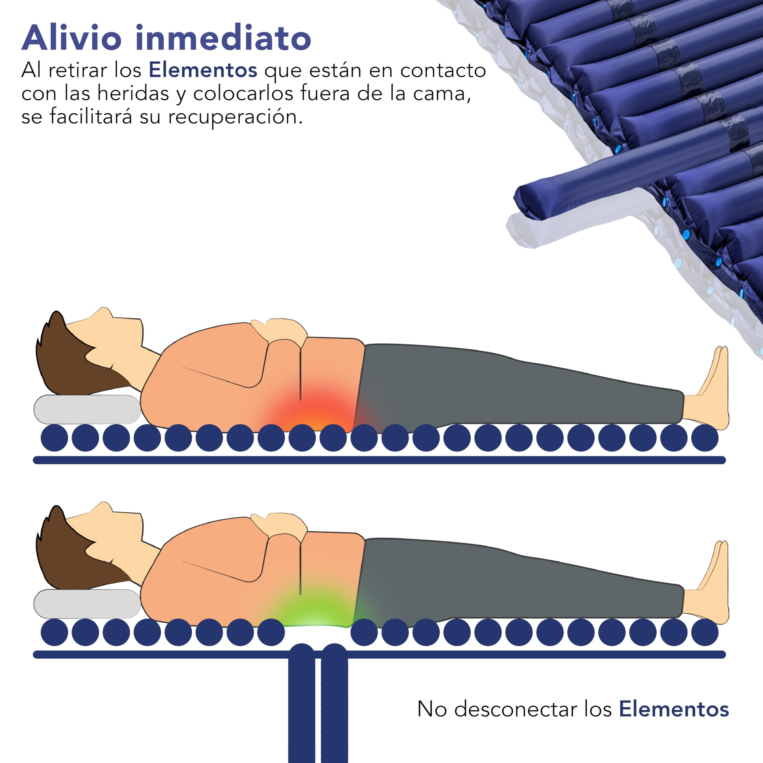 AIESI® Colchón Antiescaras de elementos intercambiables con compresor ajustable de ciclo alterno DOCTOR MATTPLUS, 22 Elementos, Capacidad 150 Kg, Silencioso, Garantía 24 meses
