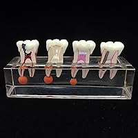 Vista 2 de Modelo de dientes dentales Modelo de tratamiento endodóntico de 4 etapas para estudiar y enseñar..