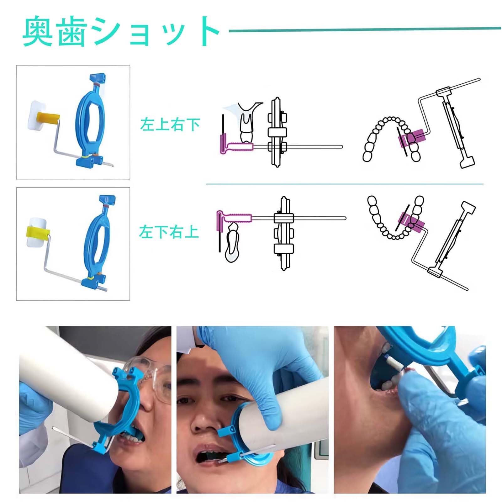 Amazon.co.jp: 歯科用X線ポジショナー、デジタルX線センサーホルダー