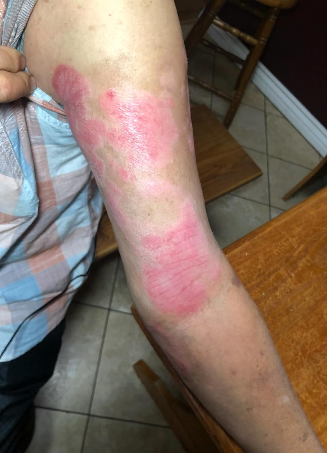 Kawakawa- Pure Healing Balm 0.18 oz (5g) (3) Natural Botanical Skin Balm with ingredients from NZ