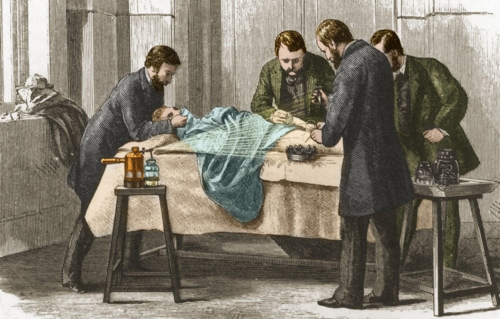 Listers Antiseptic Spray Surgery 19th Century Poster Print by Science Source (36 x 24)