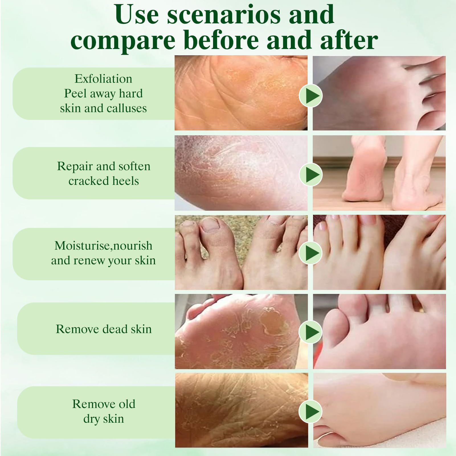 6 paia Maschera Esfoliante Piedi,Peeling Piedi,Idratante,Secchi e Screpolati,con Kit Pedicure per Uomo e Donna,Aloe Vera