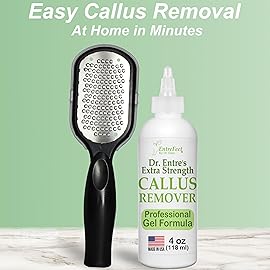 Dr. Entre\'s Callus Remover Gel & Foot File: Extra Strength Callus Remover for Feet, Foot Callus Remover Care, Pedicure Tools Supplies, Spa Kit, Dead Skin Scrubber, 4 oz