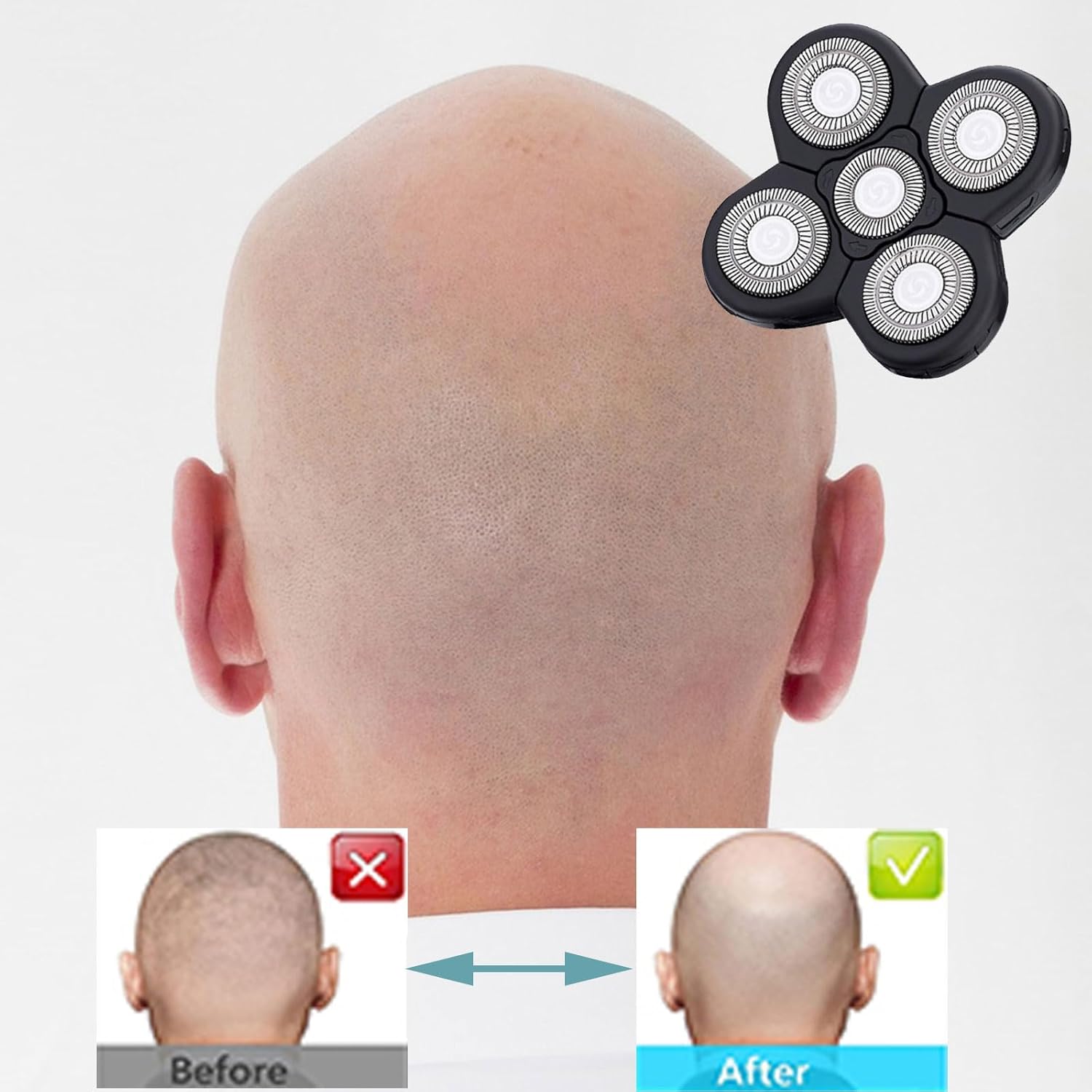 5 Blades Shaver Replacement Heads for Bald Men Easy to Clean Electric Shaver with Blade Cover - Image 5