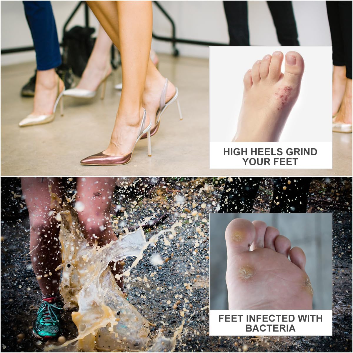 12 Sheets 108PCS Self Adhesive Callus Cushions Soft Foam Corn Pads Toe and Foot Protectors corn pads for toes,callus pads