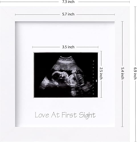 Miniatura 3 de eletecpro Marco de fotos de ultrasonido, para pantalla de fotos de ecografía de 3 x 4, marcos de fotos de sonograma para anuncio de embarazo,
