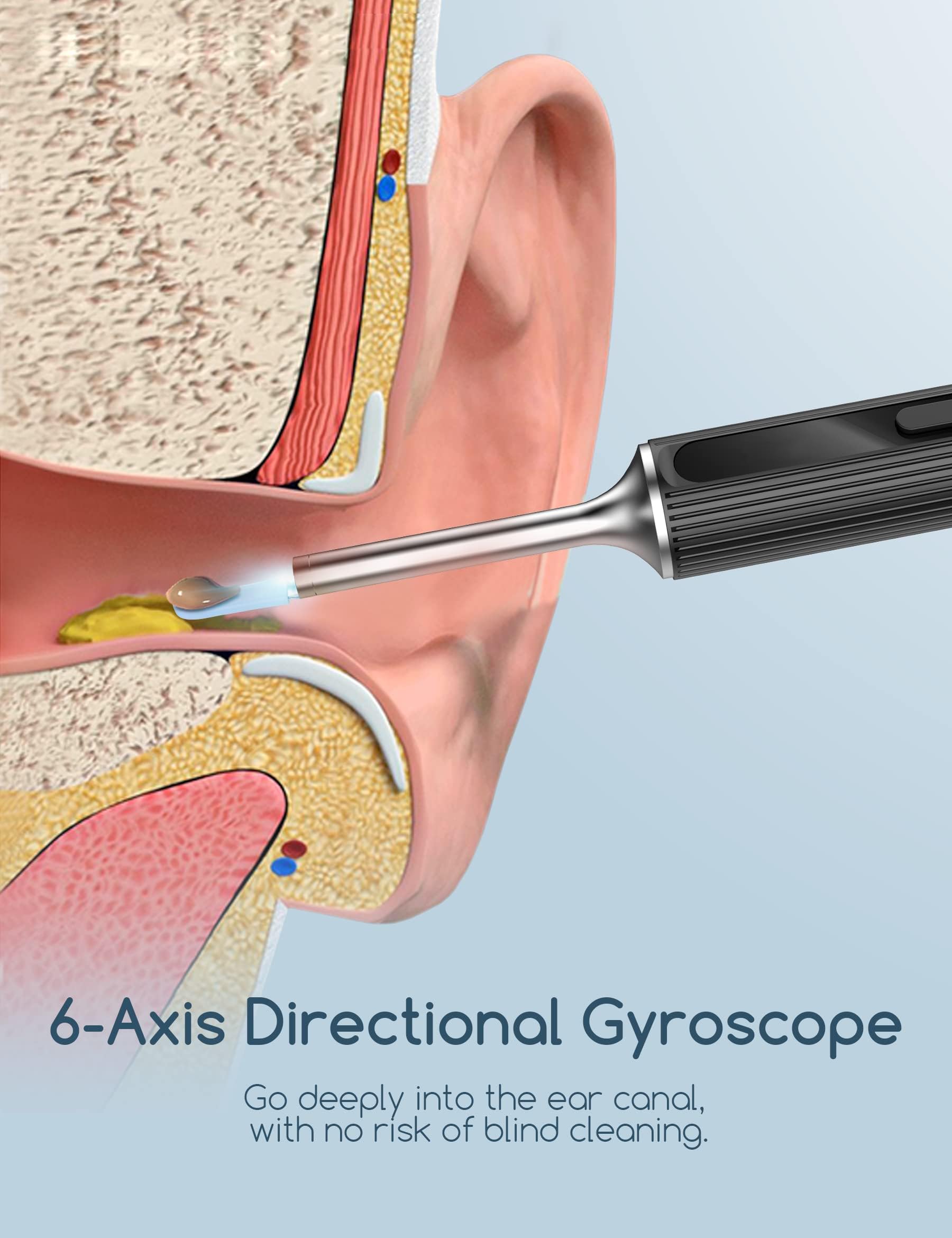 Qimic Otoscopio, Rimozione di Cerume con Telecamera, 1080P 3,5mm Impermeabile Endoscopio con 6 Luci LED, Pulisci Orecchie per iPhone, iPad e Android