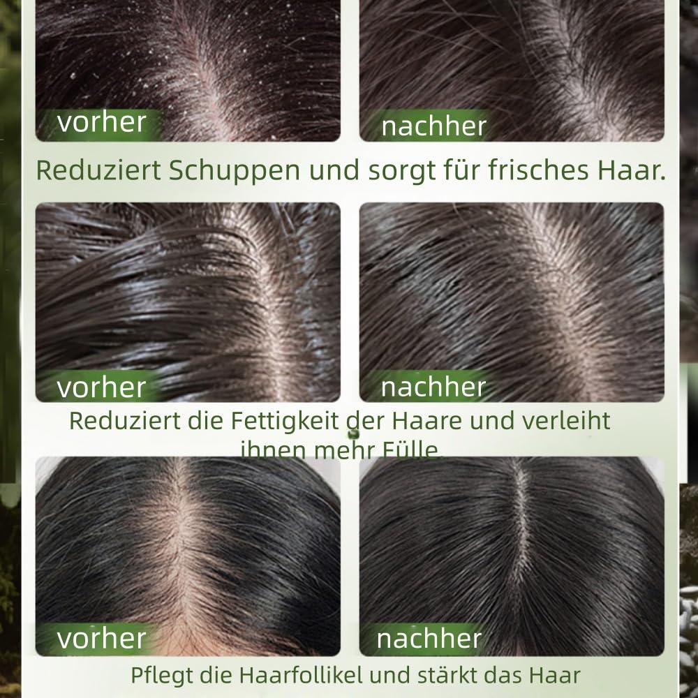 Yoracare Korean Scalp Revival Bar Feste Shampoo Bar - Pflanzenformel, Sanfte Reinigung, Nährende Pflege, für Alle Haararten, Tiefenreinigung, Rutschfeste Dreiecksform
