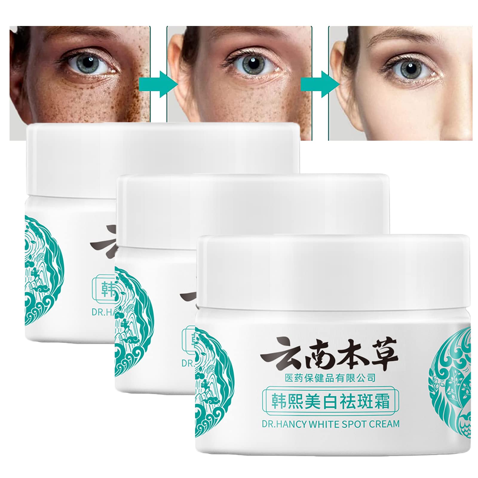 Generic Kirozi Japanese Melasma Cream, 20g Kirozi Japanese Cream for Face, Kirozi Melasma Cream Made in Japan, Herbal Skin Care Cream (3pc)