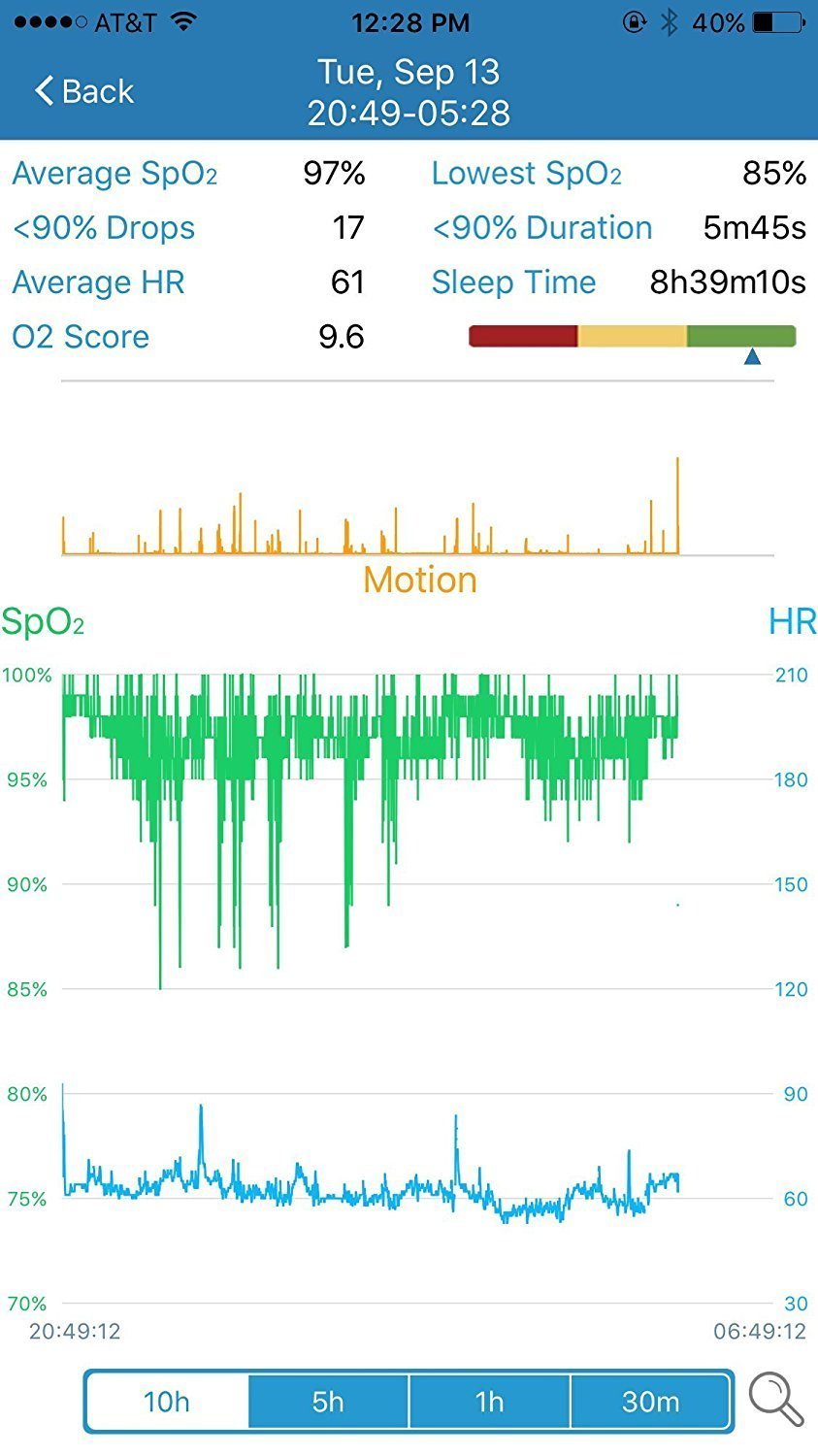 Schlafmonitor – Anti-Schnarchen Schlafhilfe Armbanduhr – Überwachung der Herzfrequenz – SpO2-Pulsoximeter-Alarm – kabellos Bluetooth für Schlafapnoe mit LED-Bildschirm