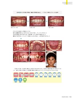 口腔習癖 実践編 河井聡 本 歯科 口腔習癖実践編 アイコンで見える化する口腔機能の問題点/医歯薬