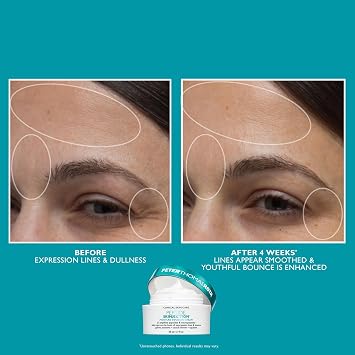 Peter Thomas Roth Peptide Skinjection™ 2-Piece Kit - Face & Eye Set with Peptides & Hyaluronic Acid - Firming Eye Cream & Moisturising Cream - Anti-Ageing Care for Smooth Skin