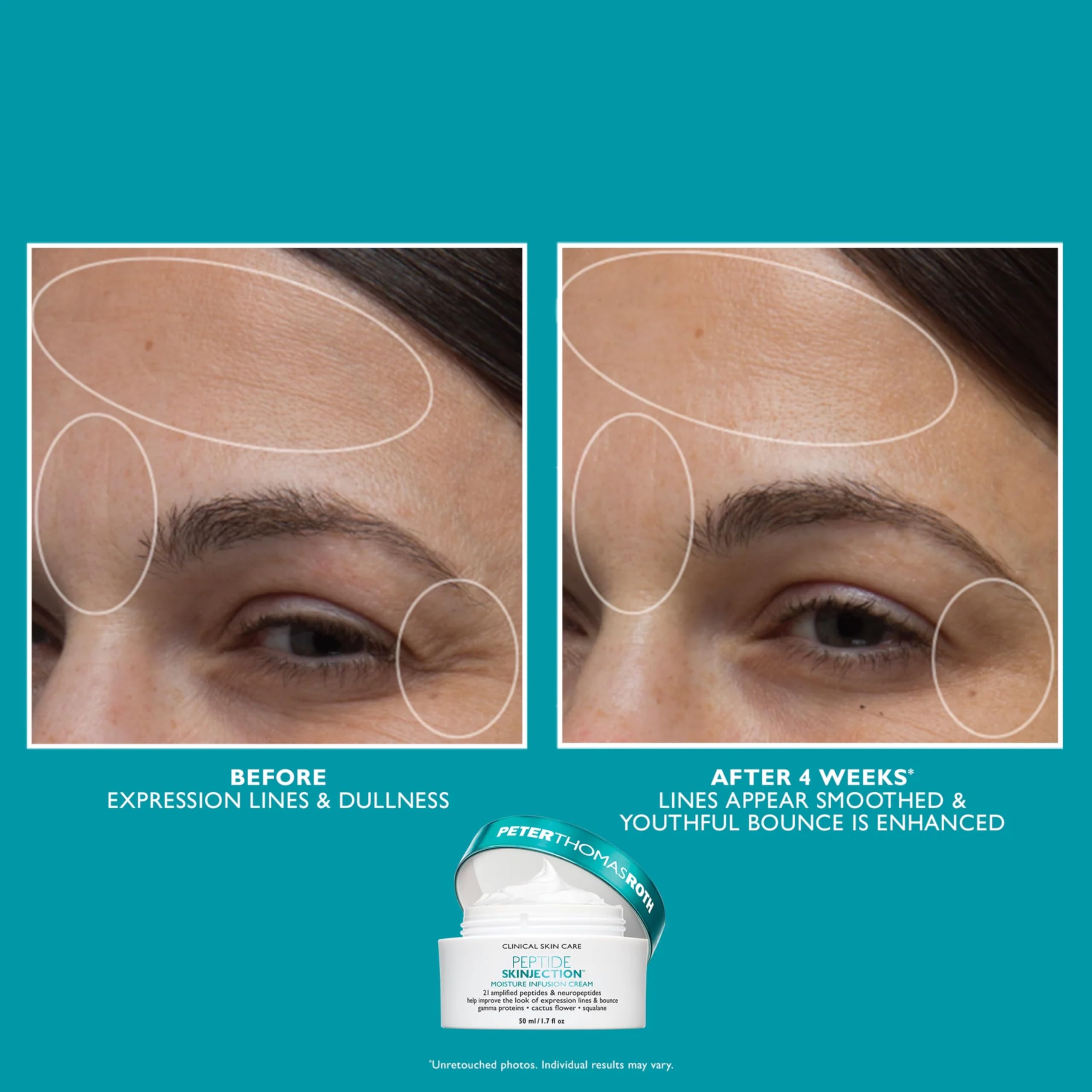 Peter Thomas Roth Peptide Skinjection™ 2-Piece Kit – Face & Eye Set mit Peptiden & Hyaluronsäure – Straffende Augencreme & Feuchtigkeitscreme – Anti-Aging Pflege für glatte Haut