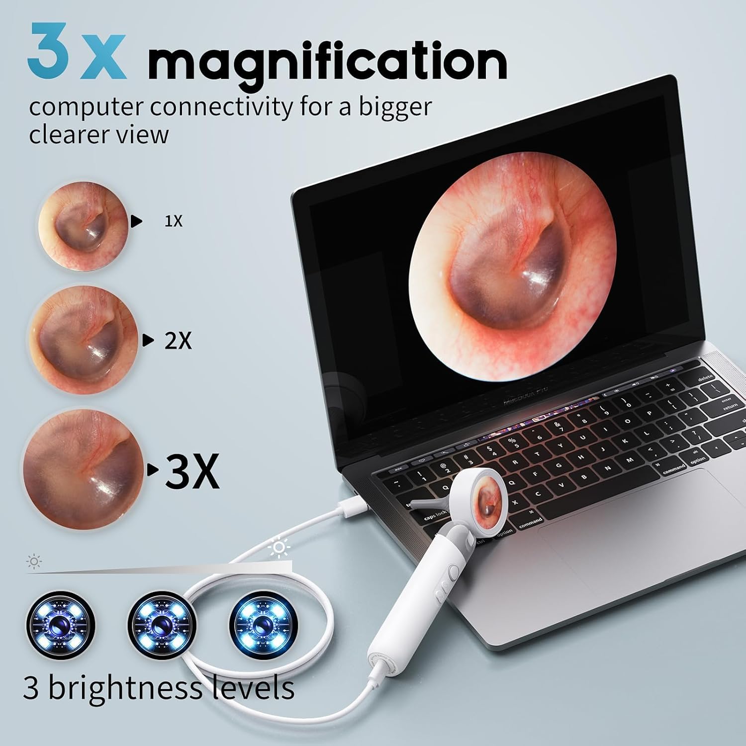 1080P HD Otoscope Ear Camera for Family, Medical Grade 1.38" Screen, Telemedicine Ready, 12 Silicone Tips and 3 Adhesive Ear Sticks, Photo/Video, Type-C Charging, Home Medical