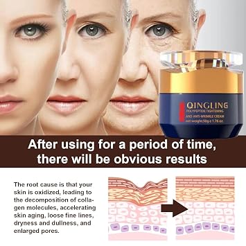 Qingling Face Cream, Quinglin Crema Para Arrugas, Qingling Wrinkle Removal Cream, Polypeptide Tightening and Anti-Wrinkle Cream, Facial Neck Eye Cream Anti-Aging