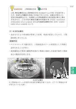 歯科国試パーフェクトマスター 22巻セット 歯科国試パーフェクトマスター 全部床義歯補綴学 | 西山 雄一郎
