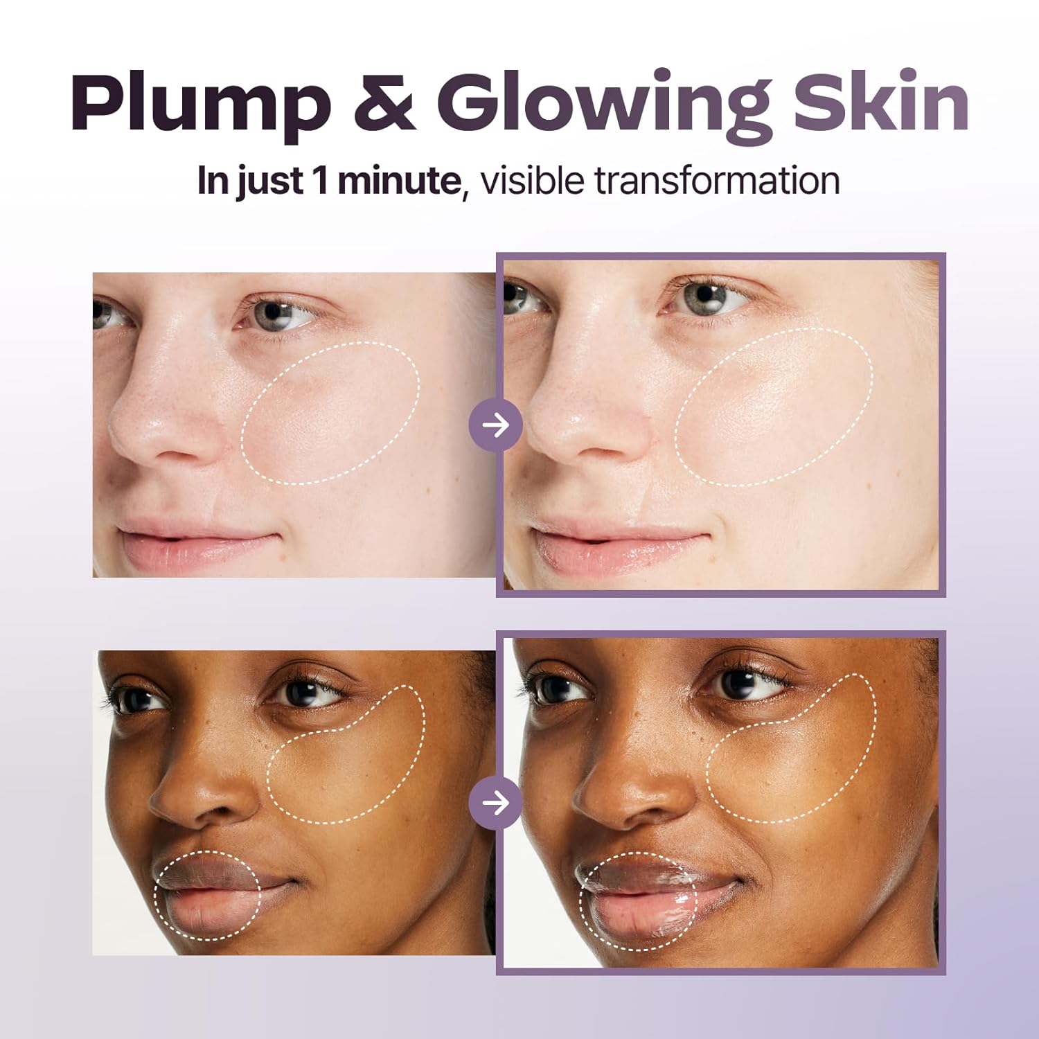 Dark Spot Care Duo : Superform Galvanic Booster Blush Pink and Glasslike Vita Glow Ampoule Serum, 1.01 fl. oz - Image 3