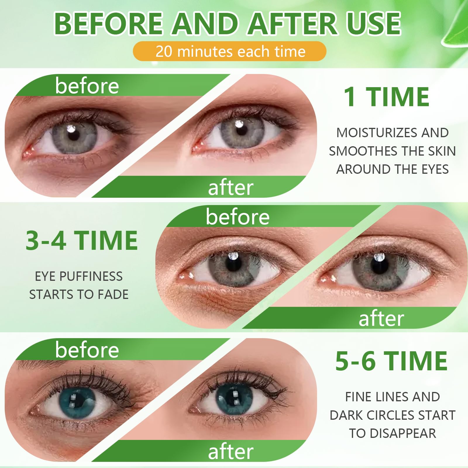 60 Pièces Aloe Patch Yeux, Patch yeux Acide hyaluronique Collagène, Eye Mask pour éclaircir et l'hydratation, Réduit les Cernes,Poches,Pattes d'Oie et Rides
