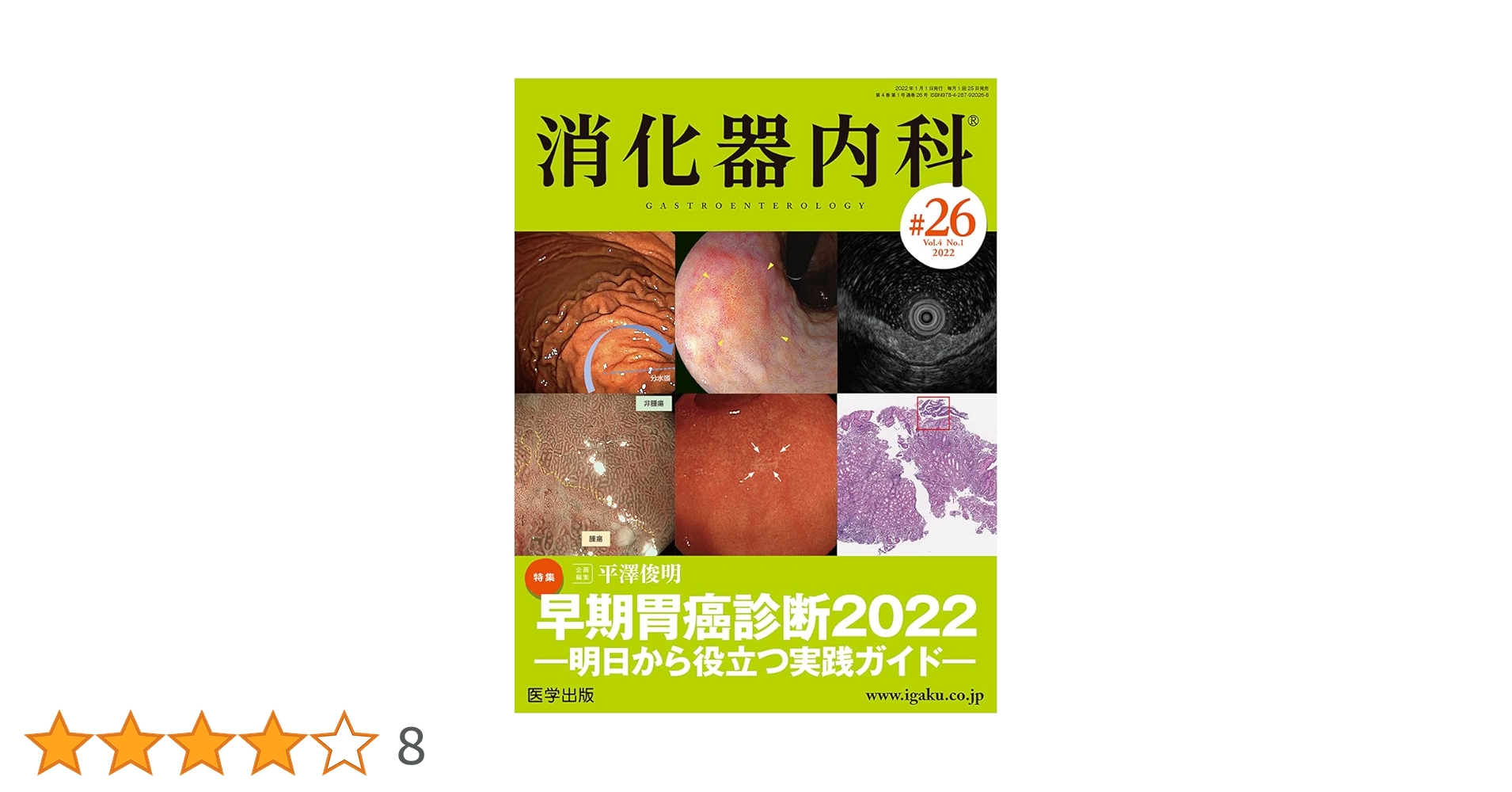 消化器内視鏡 14年7月号 26ー7 これが癌?癌じゃないの? 食道・胃編 [単行本] 消化器内視鏡編集委員会 消化器内視鏡 14年7月号 26ー7 これが癌?癌